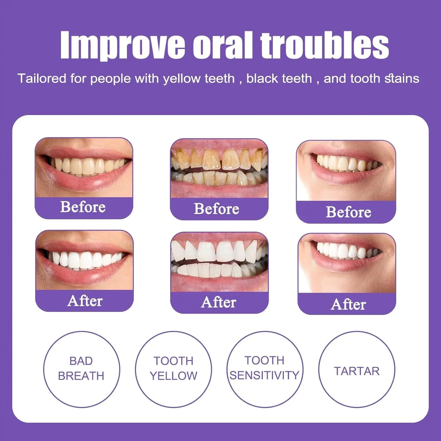 Dentifrice Violet Blanchissant Hi Smile Correcteur De Couleur Dentifrice Blanchissant Blanchiment Dentaire Purple Toothpaste Produit Violet Blanchir Les Dents Nettoyage Buccal Diamond Smile 2 PCS