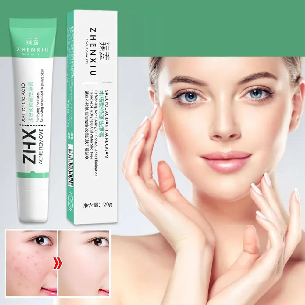 Crème à l'acide salicylique 20 g pour réduire les pores, éliminer les points noirs et lisser la peau.