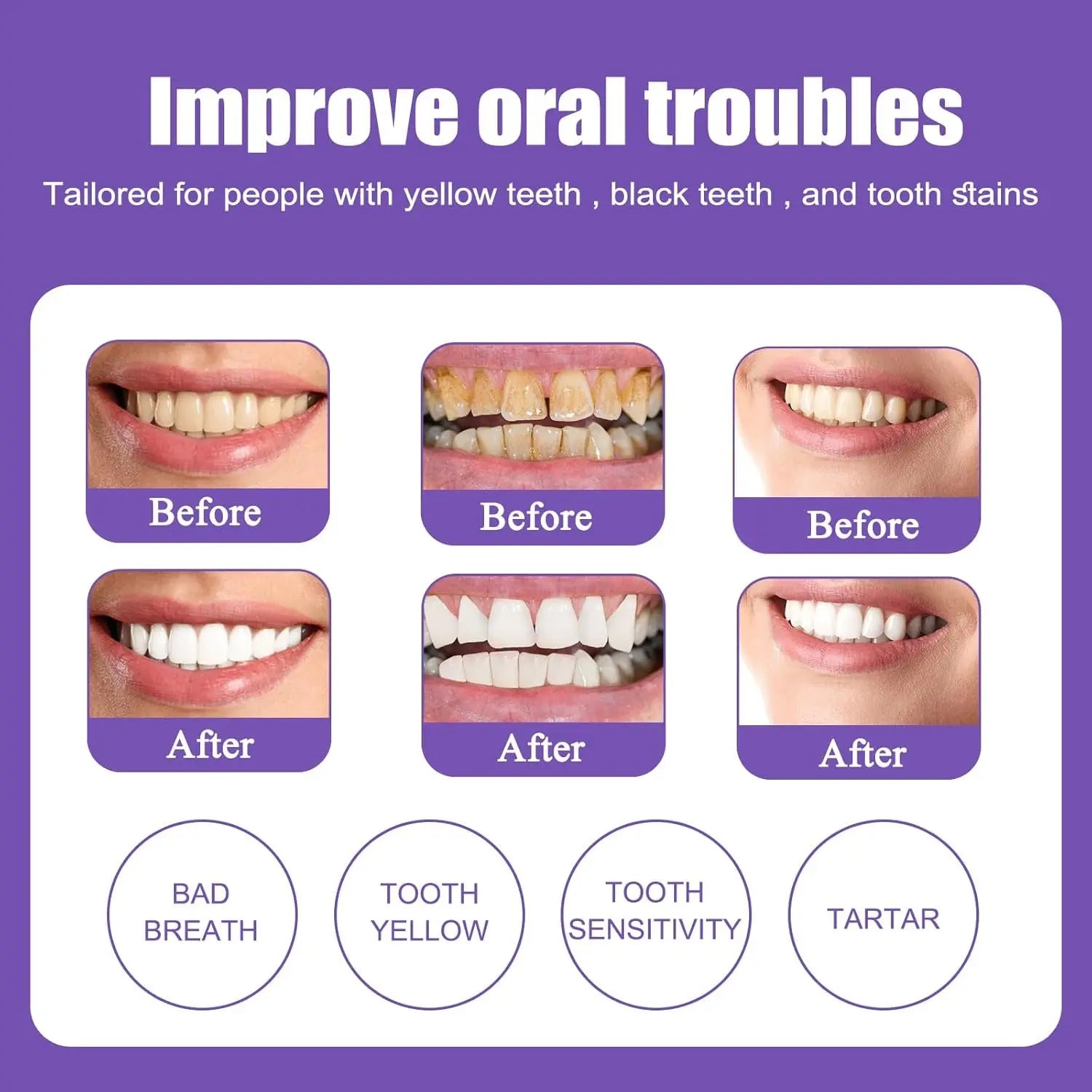 Dentifrice Violet Blanchissant Hi Smile Correcteur De Couleur Dentifrice Blanchissant Blanchiment Dentaire Purple Toothpaste Produit Violet Blanchir Les Dents Nettoyage Buccal Diamond Smile 2 PCS